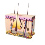 Picture image of acne follicle skin anatomy